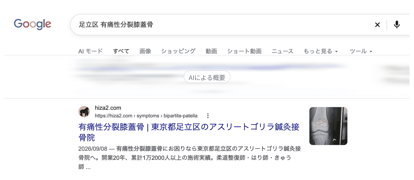 Google検索「足立区 有痛性分裂膝蓋骨」の結果。1番目にアスリートゴリラ鍼灸接骨院のページが出ている