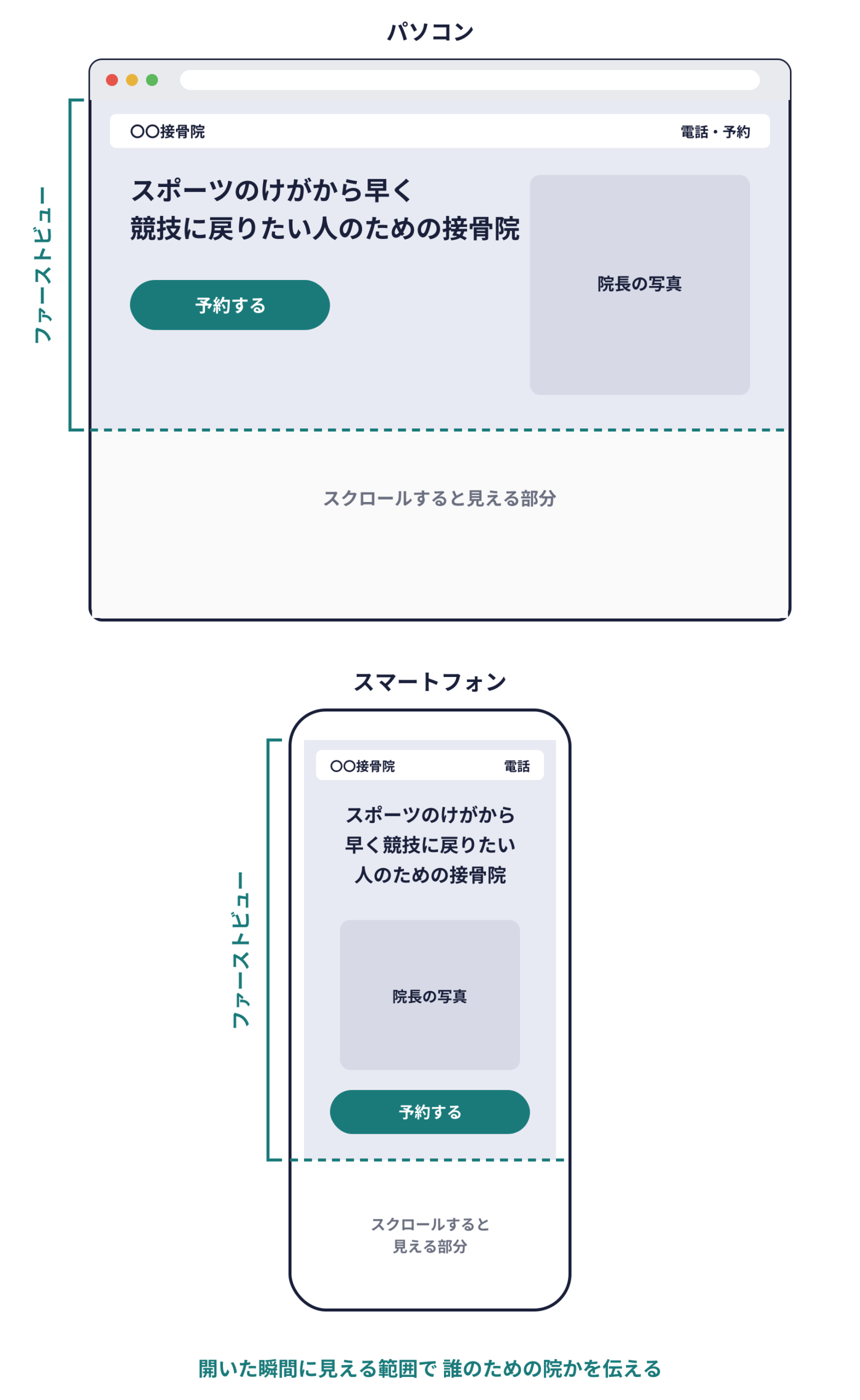 パソコンとスマートフォンのファーストビューの説明図。ホームページを開いた瞬間、スクロールせずに見える範囲がファーストビュー。その中に、院名と電話、「スポーツのけがから早く競技に戻りたい人のための接骨院」という一文、院長の写真、予約するボタンが入っている。点線より下はスクロールすると見える部分